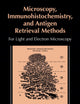 Microscopy, Immunohistochemistry, and Antigen Retrieval Methods: For Light and Electron Microscopy