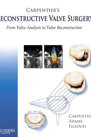 Carpentier's Reconstructive Valve Surgery