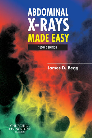 Abdominal X-Rays Made Easy