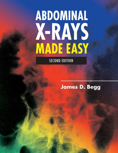 Abdominal X-Rays Made Easy