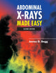 Abdominal X-Rays Made Easy