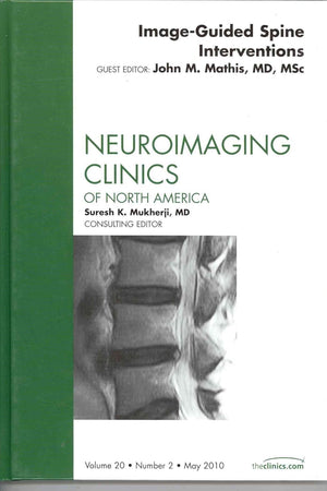 Image-Guided Spine Interventions, An Issue of Neuroimaging Clinics (Volume 20-2) (The Clinics: Radiology, Volume 20-2)
