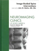 Image-Guided Spine Interventions, An Issue of Neuroimaging Clinics (Volume 20-2) (The Clinics: Radiology, Volume 20-2)