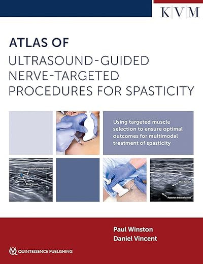 Atlas of Ultrasound-Guided Nerve-Targeted Procedures for Spasticity: Maximizing Outcomes for the Patient with Spasticity Through Optima Muscle Selection (Aesthetic Methods for Skin Rejuvination)