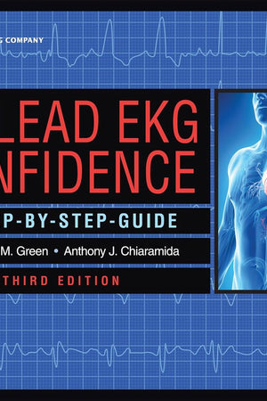 12-Lead EKG Confidence: A Step-By-Step Guide