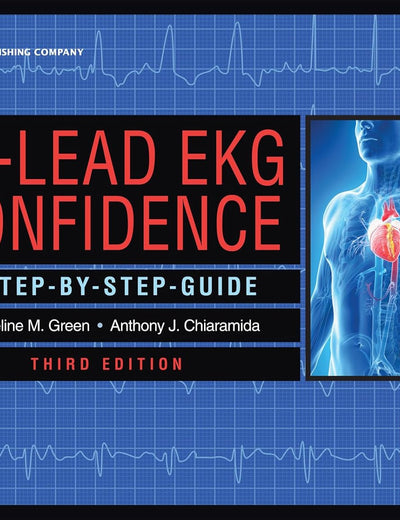 12-Lead EKG Confidence: A Step-By-Step Guide