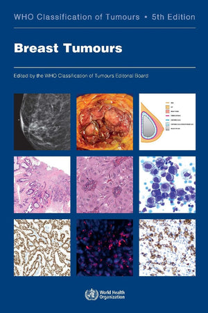 Breast Tumours: WHO Classification of Tumours (Medicine)