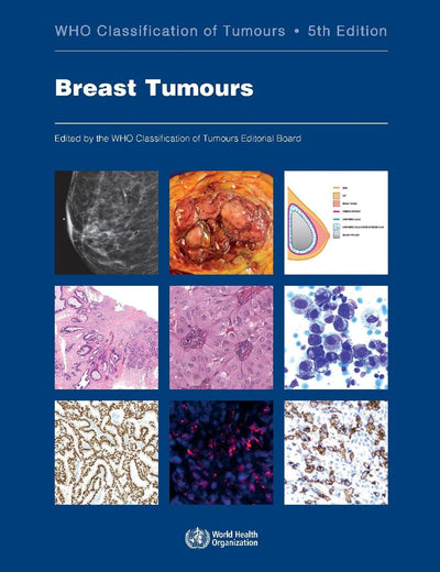 Breast Tumours: WHO Classification of Tumours (Medicine)