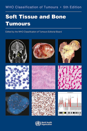 Soft Tissue and Bone Tumours: WHO Classification of Tumours (Medicine)