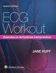 ECG Workout: Exercises in Arrhythmia Interpretation