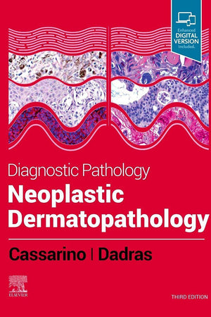 Diagnostic Pathology: Neoplastic Dermatopathology