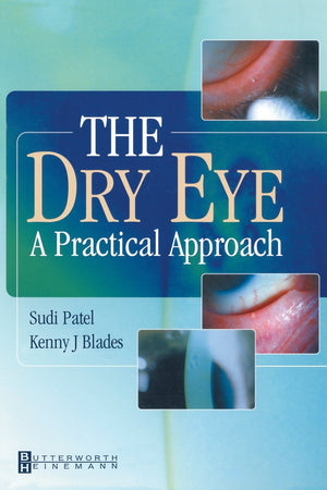 The Dry Eye: A Practical Approach
