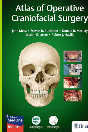 Atlas of Operative Craniofacial Surgery