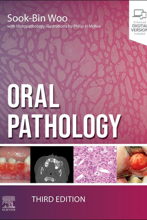 Oral Pathology