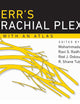 Kerr's Brachial Plexus