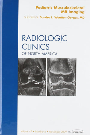 Pediatric Musculoskeletal MR Imaging, An Issue of Radiologic Clinics of North America (Volume 47-6) (The Clinics: Radiology, Volume 47-6)