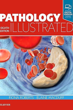 Pathology Illustrated