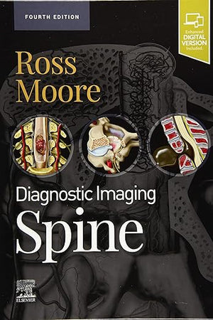 Diagnostic Imaging: Spine