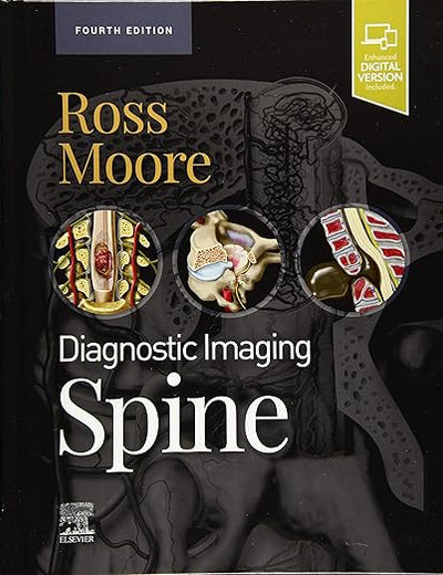 Diagnostic Imaging: Spine