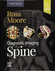 Diagnostic Imaging: Spine