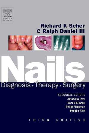 Nails: Diagnosis, Therapy, Surgery