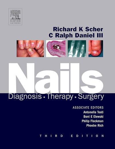 Nails: Diagnosis, Therapy, Surgery