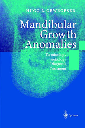 Mandibular Growth Anomalies: Terminology - Aetiology Diagnosis - Treatment