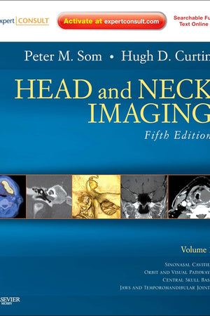 Head and Neck Imaging