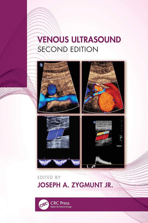 Venous Ultrasound