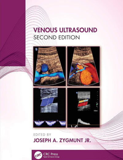 Venous Ultrasound