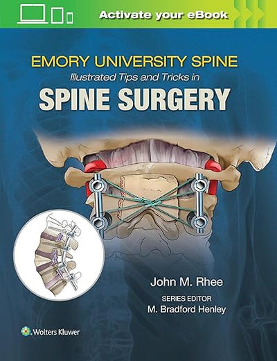 Emory's Illustrated Tips and Tricks in Spine Surgery