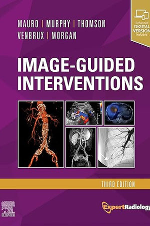 Image-Guided Interventions: Expert Radiology Series