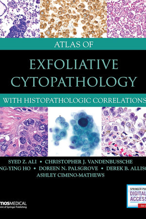 Atlas of Exfoliative Cytopathology: With Histopathologic Correlations