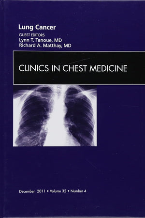 Lung Cancer, An Issue of Clinics in Chest Medicine (Volume 32-4) (The Clinics: Internal Medicine, Volume 32-4)