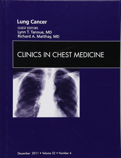 Lung Cancer, An Issue of Clinics in Chest Medicine (Volume 32-4) (The Clinics: Internal Medicine, Volume 32-4)
