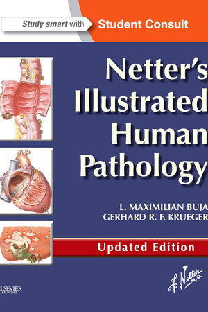 Netter's Illustrated Human Pathology Updated Edition: with Student Consult Access (Netter Basic Science)