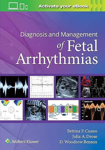 Diagnosis and Management of Fetal Arrhythmias