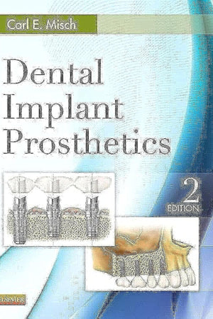Dental Implant Prosthetics