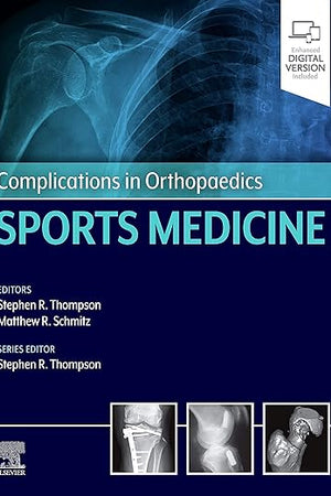 Complications in Orthopaedics: Sports Medicine