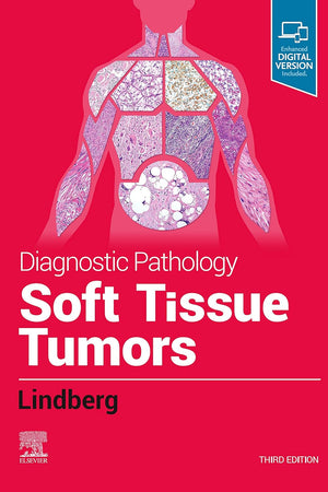 Diagnostic Pathology: Soft Tissue Tumors