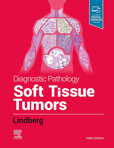 Diagnostic Pathology: Soft Tissue Tumors