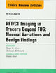 PET/CT Imaging in Tracers Beyond FDG, An Issue of PET Clinics (Volume 9-3) (The Clinics: Radiology, Volume 9-3)