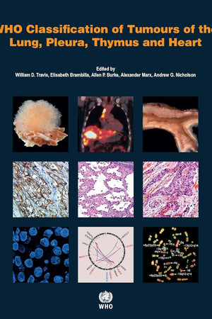 WHO Classification of Tumours of the Lung, Pleura, Thymus and Heart [OP]