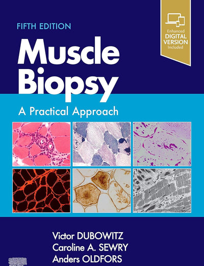 Muscle Biopsy: A Practical Approach