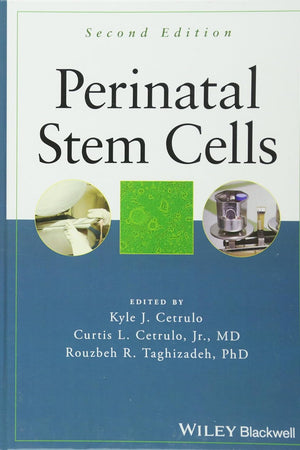 Perinatal Stem Cells