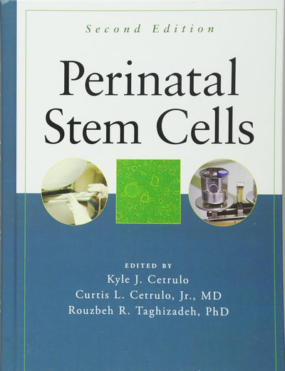 Perinatal Stem Cells