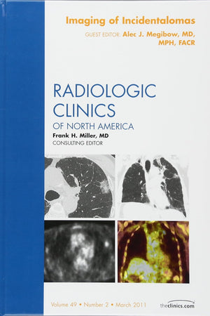 Imaging of Incidentalomas, An Issue of Radiologic Clinics of North America (Volume 49-2) (The Clinics: Radiology, Volume 49-2)