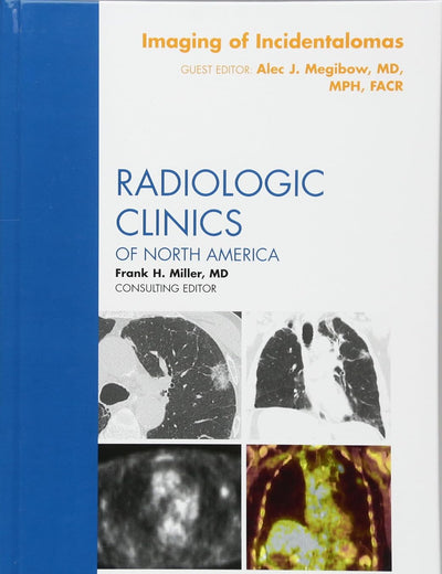 Imaging of Incidentalomas, An Issue of Radiologic Clinics of North America (Volume 49-2) (The Clinics: Radiology, Volume 49-2)