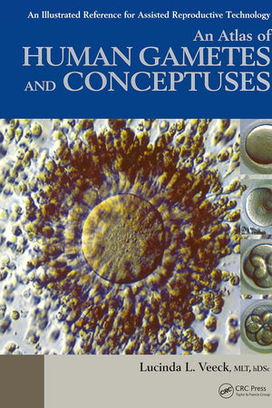 An Atlas of Human Gametes and Conceptuses: An Illustrated Reference for Assisted Reproductive Technology (The Encyclopedia of Visual Medicine Series)