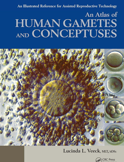 An Atlas of Human Gametes and Conceptuses: An Illustrated Reference for Assisted Reproductive Technology (The Encyclopedia of Visual Medicine Series)